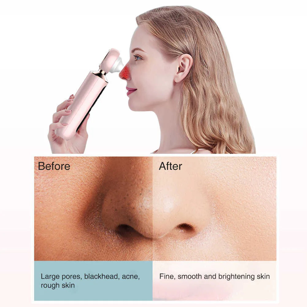 Nivara™ Blackhead Suction Machine