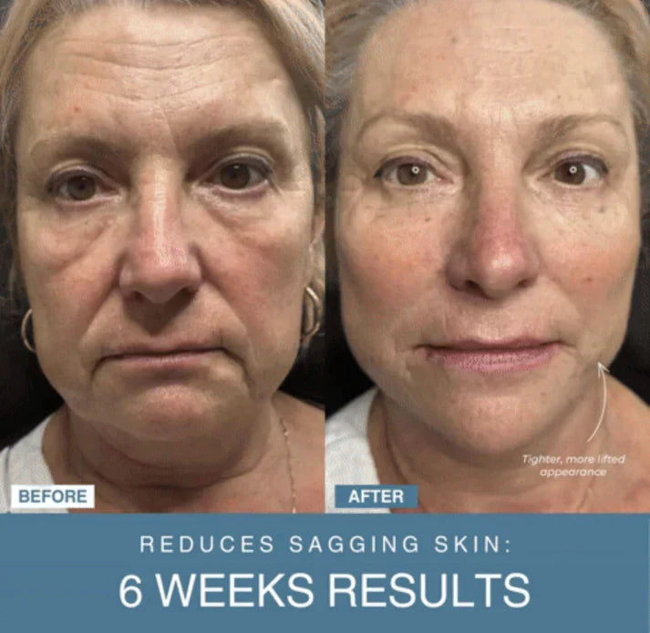 Nivara™ 7-in-1 LED Anti-Aging/Wrinkle Apparatus