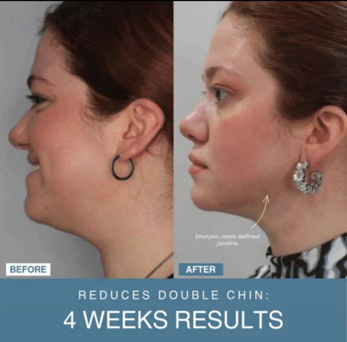 Nivara™ 7-in-1 LED Anti-Aging/Wrinkle Apparatus