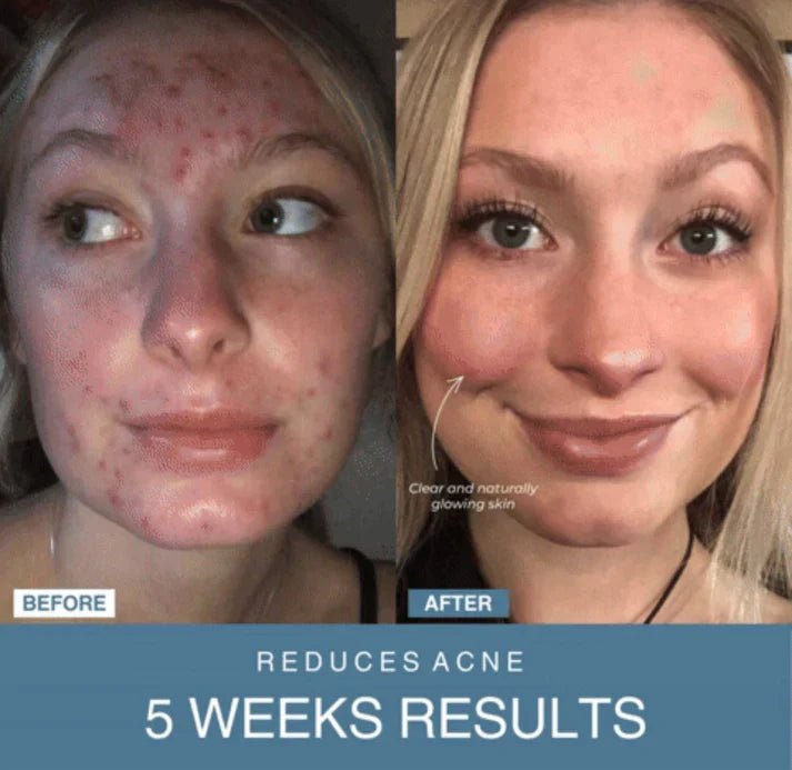Nivara™ 7-in-1 LED Anti-Aging/Wrinkle Apparatus