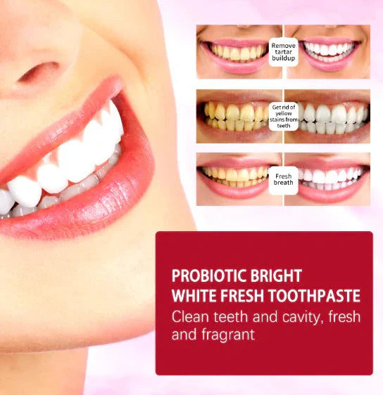Nivara™Sp-4 Toothpaste